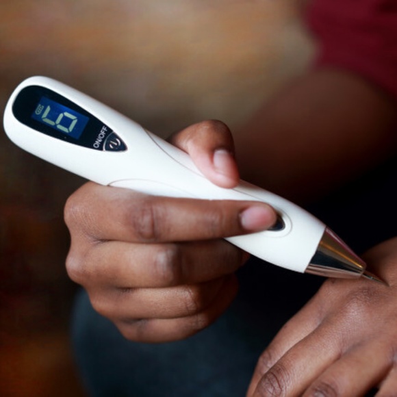 Laser Plasma Pen Mole Removal Dark Spot Skin Tag Tattoo Mole Wart Remover Pen - Picture 4 of 5